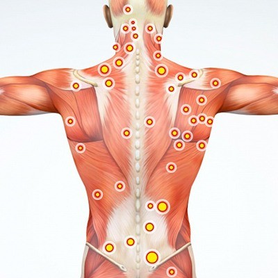MYOTHERAPY-2